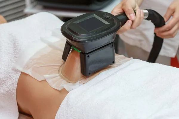 Image of person having fat freezing treatment to help weight gain Bridgend