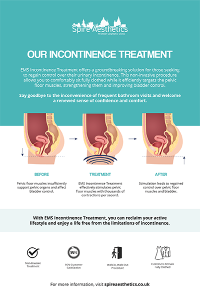 image of how urge incontinence Bridgend treatment works