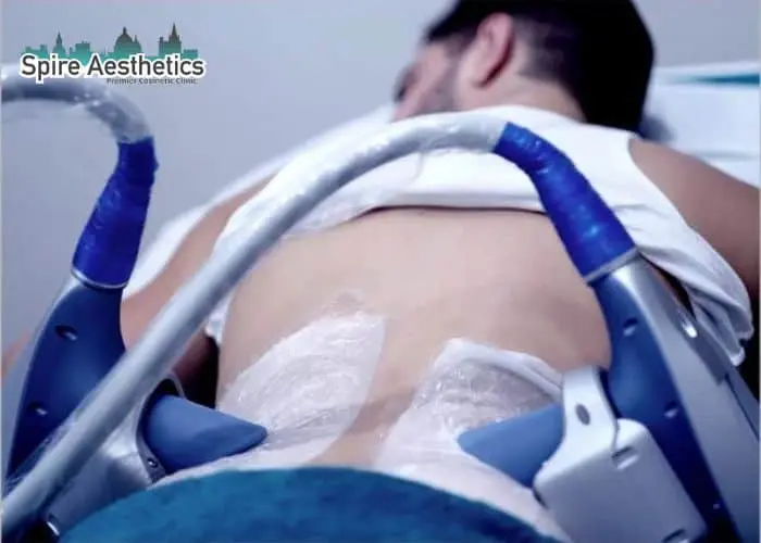 Man having fat freezing treatment done on love handles before a competitions Bridgend to create a sculpted look.