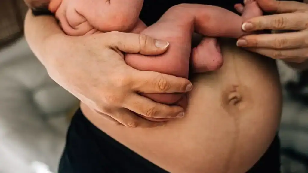 Why Is My Stomach Still Big After Pregnancy Bridgend?